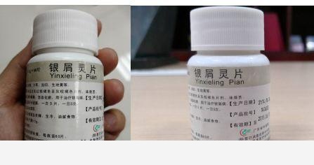 銀屑病面面觀｜數一數廣東省中醫院的「驅銀」神器藥物！